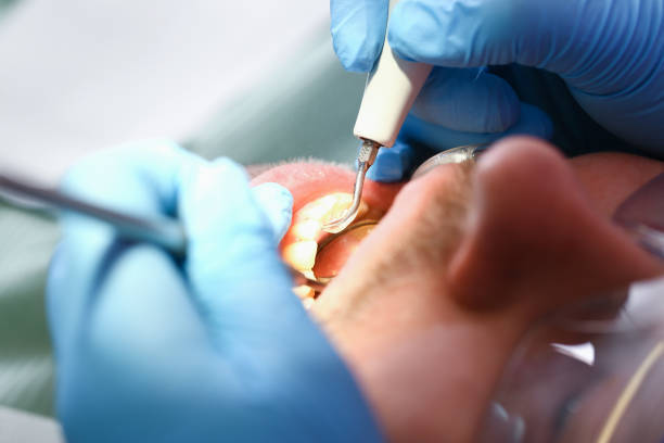Best Root Canal Emergency Dentist  in Salina, OK