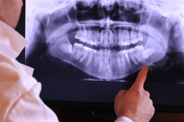 Best Chipped Tooth Repair Near Me  in Salina, OK