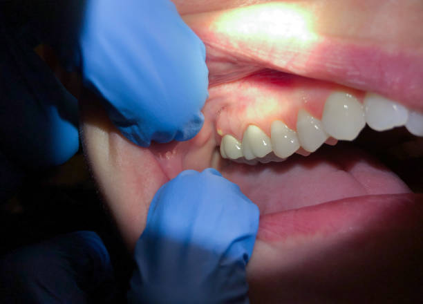 Emergency Dentist for Kids in OK