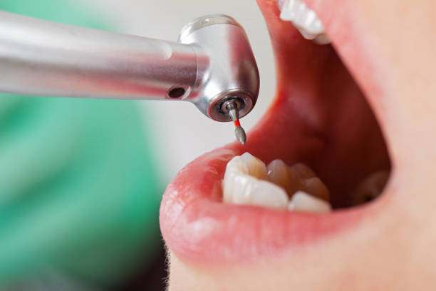 Tooth Infection Emergency Dentist in OK